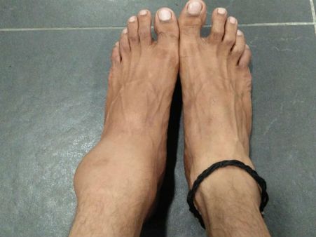 மலேசியாவில் நடந்த கால்பந்தாட்ட போட்டியில் மேலும் ஒரு நடிகர் காயம்