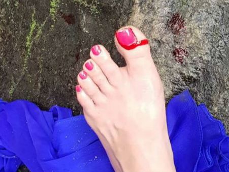 படப்பிடிப்பில் காயம்: ரத்தக்கறை புகைப்படத்தை வெளியிட்ட நடிகை வேதிகா