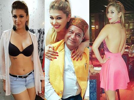 வழுக்கை விழுந்ததால் ரூ. 7 லட்சத்திற்கு முடி நடவு செய்த பிக் பாஸ் பிரபலம்