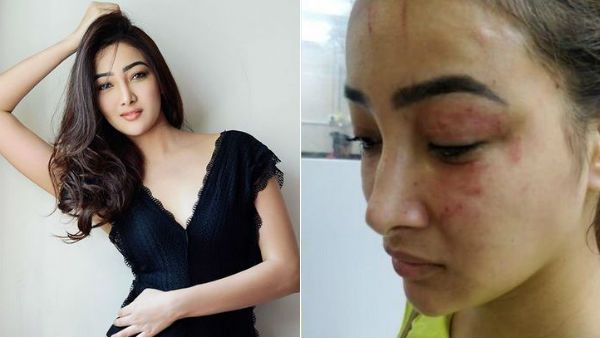 என் ரூம்மேட்டும், அம்மாவும் சேர்ந்து தாக்கினார்கள்: காயத்துடன் போலீசிடம் சென்ற நடிகை