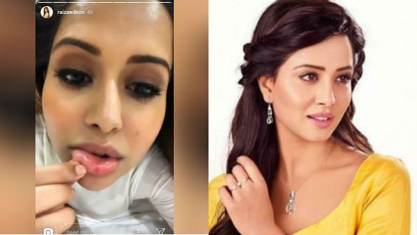 அய்யோ பாவம்.. இதெல்லாம் தேவையா.. செல்பி எடுக்கப் போய் உதட்டில் காயமடைந்த பிக் பாஸ் நடிகை!