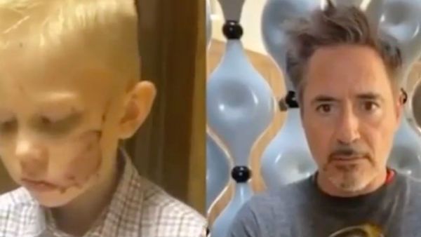 நாயிடம் இருந்து தங்கையை காப்பாற்றிய சிறுவன்.. பரிசு கொடுக்கும் அயன்மேன், ஸ்பைடர்மேன் நடிகர்கள்!