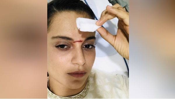 ஷுட்டிங்கில் வீசப்பட்ட நிஜ வாள்.. நெற்றியில் 15 தையல்.. நடிகையின் போட்டோவை பார்த்து பதறிய ஃபேன்ஸ்!