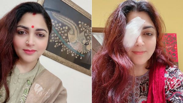 நடிகை குஷ்புவுக்கு கண்ணில் அறுவை சிகிச்சை.. போட்டோவை பார்த்து பதறும் ரசிகர்கள்!