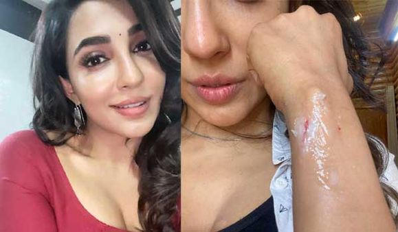 படப்பிடிப்பின் போது ஏற்பட்ட திடீர் விபத்து.. அஜித் பட நடிகைக்கு பலத்த காயம்.. அப்செட்டில் படக்குழு!