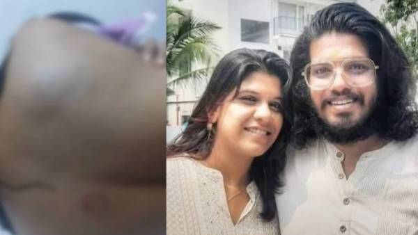 ஷாக்.. பிரபல நடிகரின் மனைவி தூக்கிட்டு தற்கொலை.. உடம்பில் காயங்கள்.. நடிகர் மீது பெற்றோர் புகார்!