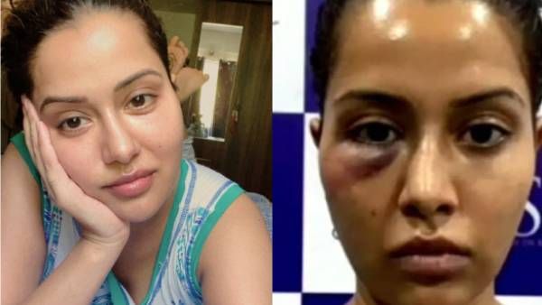 படுக்கை அறையில் படுத்துக் கொண்டு போஸ் கொடுத்த ரைசா.. வீக்கம் சரியாகிடுச்சான்னு விசாரிக்கும் ஃபேன்ஸ்