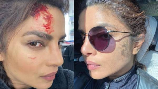 நெற்றியில் ரத்தம் சொட்ட சொட்ட போட்டோ ஷேர் செய்த பிரபல நடிகை.. பதறும் ரசிகர்கள்!