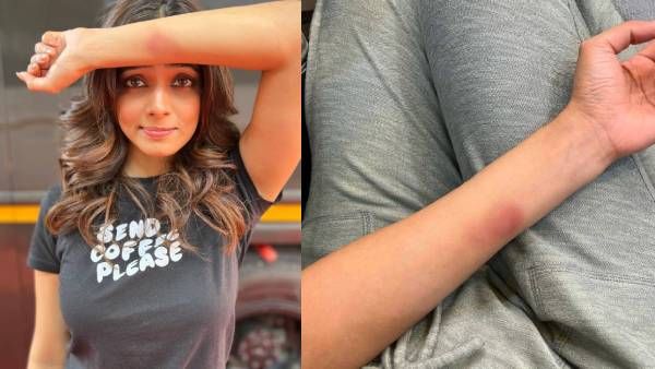 அச்சச்சோ.. சூட்டிங் ஸ்பாட்டில் மாளவிகா மோகனனுக்கு இப்படி அடிப்பட்டுடுச்சே.. பதறிப்போன ரசிகர்கள்!