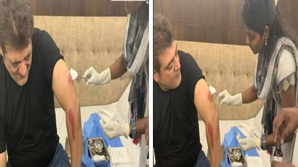 கிழிந்த பேன்ட்...கையில் ரத்த காயங்களுடன் அஜித்...ஆச்சச்சோ என்னச்சு ஏகே.,வுக்கு ?