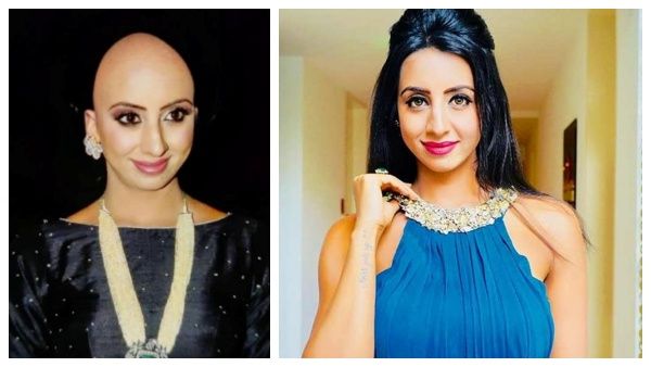 மொட்டைதலையுடன் சஞ்சனா கல்ராணி… என்ன ஆச்சு…ஏன் இந்த முடிவு !