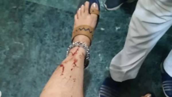 அதிவேக பயணம்... தறிகெட்டு ஓடிய கார்... விபத்தில் சிக்கிய பிரபல நடிகை !