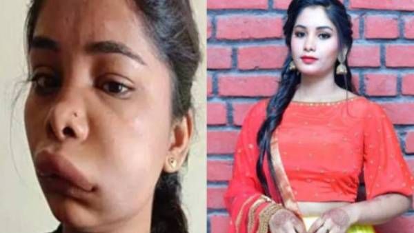 பல் வலிக்கு சிகிச்சை.. வீங்கியது முகம்.. கதறும் நடிகை.. நடந்தது என்ன?