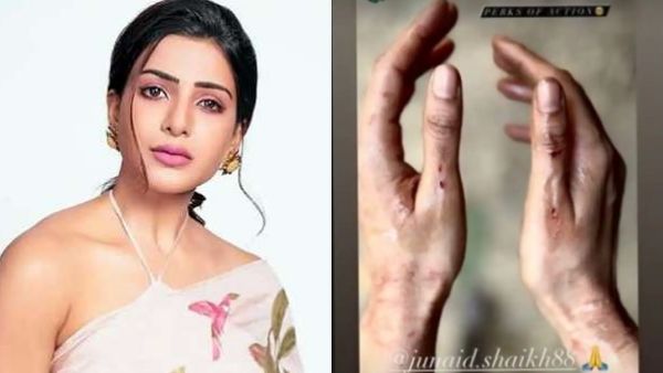 கையில் பலத்த காயம்.. சமந்தாவுக்கு என்ன ஆச்சு.. பதறிய ரசிகர்கள் !