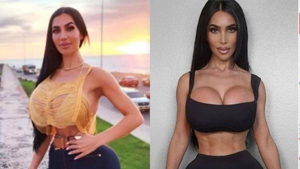 அதிர்ச்சி.. 34 வயசு தான்.. கிம் கர்தாஷியன் மாதிரி இருந்தாரே.. பிளாஸ்டிக் சர்ஜரியால் பரிதாப பலி