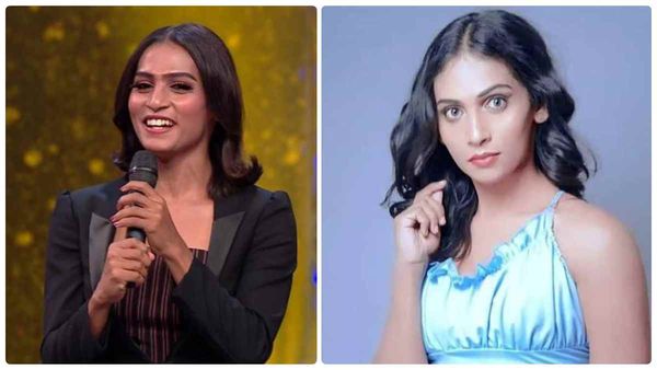 2 வருஷம் ஆகும்.. இப்படித்தான் நான் சர்ஜரி பண்ணிக்கிட்டேன்.. பிக் பாஸ் ஷிவின் ஓபன் டாக்!