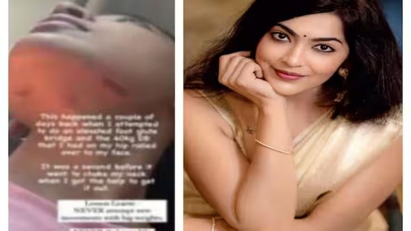 VJ Ramya: உடற்பயிற்சியின் போது விபத்து.. வி.ஜே ரம்யா முகத்தில் காயம்.. பதறிய பேன்ஸ்!