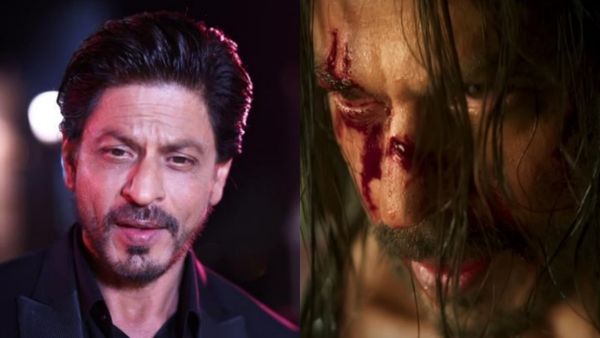 அச்சச்சோ ஷாருக்கானுக்கு என்ன ஆச்சு? ஷூட்டிங் ஸ்பாட்டில் விபத்து.. மூக்கில் இருந்து கொட்டிய ரத்தம்!