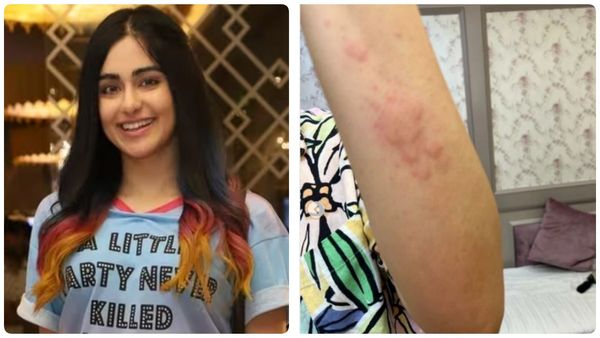 திடீர் அலர்ஜி.. கை கால்களில் தடிப்பு.. பிரபல நடிகை மருத்துவமனையில் அனுமதி.. ரசிகர்கள் கவலை