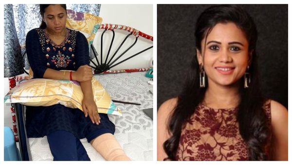 அடக்கடவுளே.. காலில் கட்டு.. குக்வித் கோமாளி மணிமேகலைக்கு என்னாச்சு.. பதறிய ரசிகர்கள்!