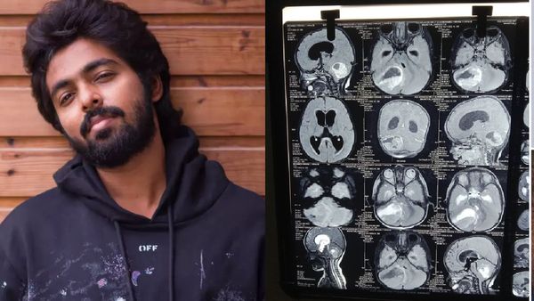 மூளையில் கட்டி.. துடிக்கும் ஒரு வயது சிறுவன்.. உதவிக்கரம் நீட்டிய ஜி.வி. பிரகாஷ் குமார்!