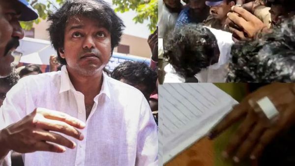 விஜய் கையில் இவ்வளவு பெரிய காயமா?.. வெளியான புகைப்படம்.. ரசிகர்கள் சோகம்