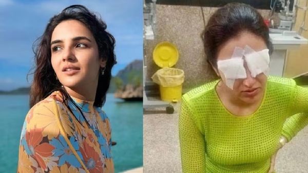 Jasmin bhasin: லென்ஸ் அணிந்ததால் பாதிக்கப்பட்ட கண் பார்வை.. சிக்கலில் வானம் பட நடிகை!