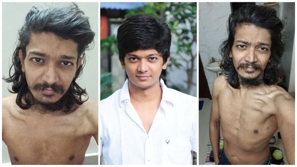 தனி அறையில் எலும்பு தோலுமாக இருக்கும் மாநகரம் ஹீரோ.. ஸ்ரீயை பார்க்கவே பாவமா இருக்கு!