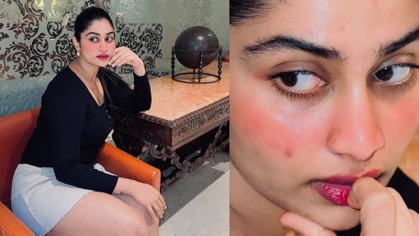 முகமெல்லாம் சிவந்து கிடக்கே.. இவ்ளோ ஜூம் எல்லாம் தாங்காது ஷிவானி.. ஃபீல் பண்ணும் ஃபேன்ஸ்!