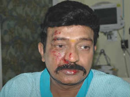 మహంకాళి షూటింగులో గాయపడిన రాజశేఖర్ కోలుకుంటున్నారు