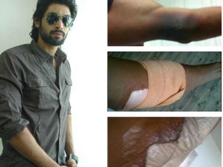 వామ్మో... రాణాకు ఎంత పెద్ద గాయం!