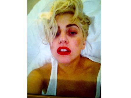 అభిమానుల కోసం ట్విట్టర్‌లో ముఖం వాచిపోయిన ఫోటో