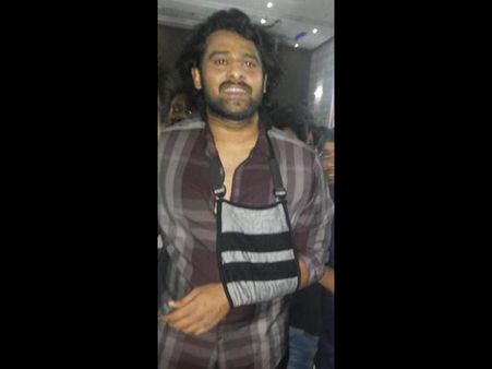 నిజమే...సర్జరీ చేయించుకున్నా: ప్రభాస్