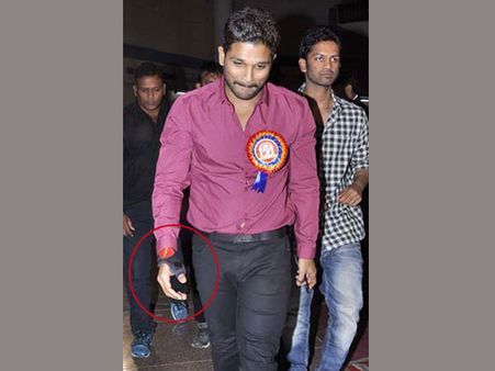 ‘సరైనోడు’ షూటింగులో గాయపడ్డ అల్లు అర్జున్