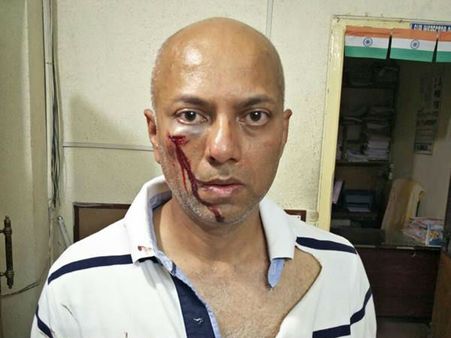 తెలుగు సంగీత దర్శకుడిపై దాడి, తీవ్ర గాయాలు