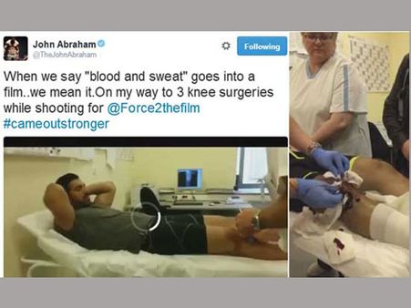 షాక్: స్టార్ హీరో మోకాలికి సర్జరీ,ఆపరేషన్ జరిగేటప్పుడు వీడియో ఇది