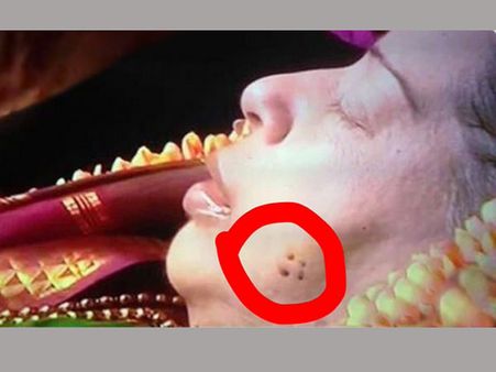 షాకింగ్ :జయలలిత బుగ్గపై ఈ రంధ్రాలు, దేహం కుళ్లకుండా సూది వేశారా? మరేమైనా?