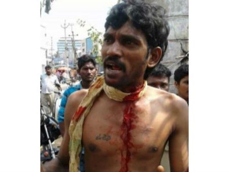 మెగా పిచ్చి: బ్లేడుతో గొంతుకోసుకున్న అభిమాని (ఫోటో)