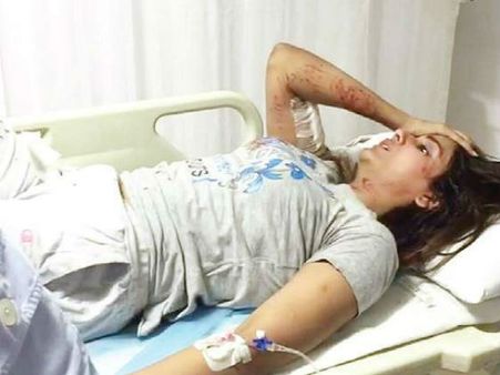 రక్షిద్దామనుకుంటే వీధి కుక్కల దాడి, వర్మ హీరోయిన్‌కు తీవ్రగాయాలు