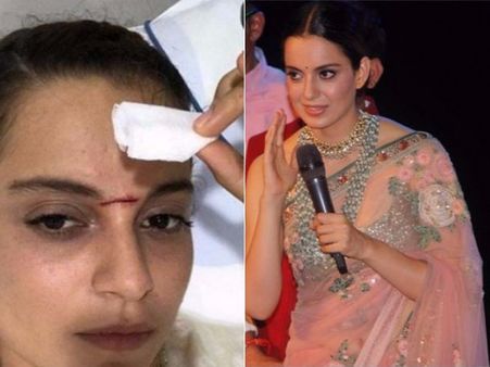 హీరోయిన్ కంగనకు కత్తిగాట్లు.... తృటిలో పెద్ద ప్రమాదం తప్పింది!