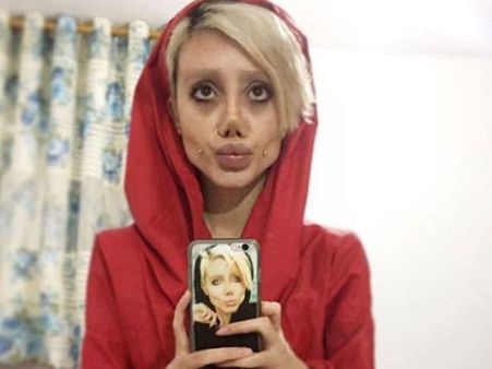 ఆ హీరోయిన్‌ అంటే పిచ్చి: 50 సర్జరీలకు తెగించిన అభిమాని, షాకింగ్ లుక్