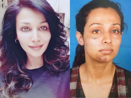 హీరోయిన్‌ను దారుణంగా కొట్టిన నిర్మాత (షాకింగ్ ఫోటోస్)