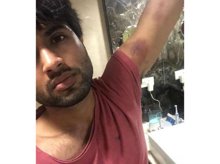 వైరల్ అవుతున్న ఫోటో.... విజయ్ దేవరకొండకు ఏమైంది?