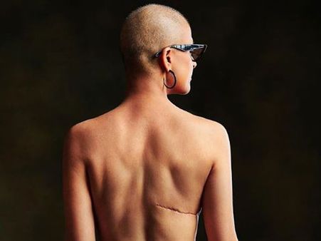 హీరో భార్య బ్యాక్‌లెస్ ఫోటో: వీపుపై మచ్చ చూపించడం కష్టంగా ఉందంటూనే...