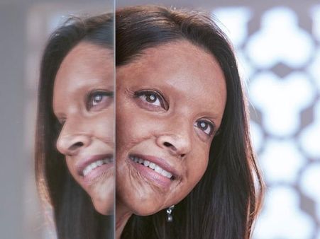 అందవిహీనంగా దీపిక పదుకోన్: ‘ఛపాక్’ ఫస్ట్ లుక్ షాకింగ్