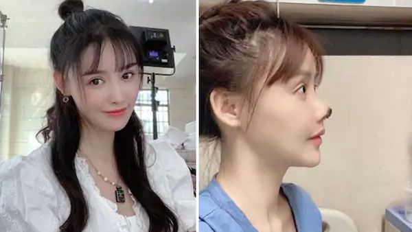 యువ హీరోయిన్‌కు వికటించిన ప్లాస్టిక్ సర్జరీ.. చికిత్స తర్వాత ఏం జరిగిందంటే..