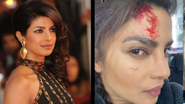 Priyanka Chopra : షూట్ లో ముఖానికి గాయాలు, రక్తస్రావం .. తీవ్ర టెన్షన్లో ఫ్యాన్స్!