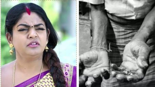 కొంప ముంచిన కార్తీక దీపం: ఆ కోపంతో అమాంతం వేలు కొరికేసి.. ప్రాణం మీదకు తెచ్చిన సీరియల్ పిచ్చి