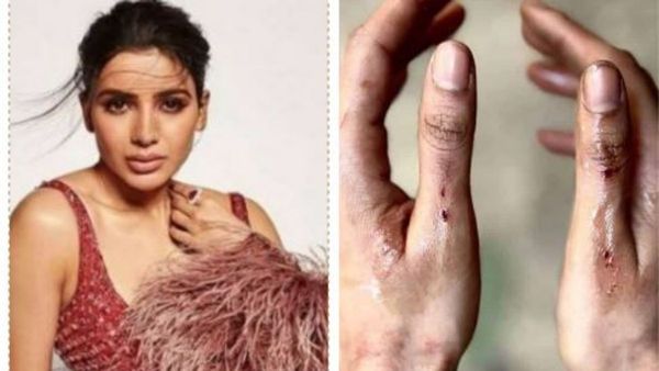 Samantha చేతికి గాయాలు.. రక్తం కనిపించేలా షాకింగ్ ఫొటో!