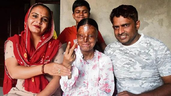 Success Story: कौन है एसिड अटैक सर्वाइवर कैफी? 3 साल की उम्र में हुआ हमला, 12वीं में टॉप करके रचा इतिहास!